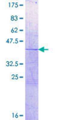 SDS-PAGE: Recombinant Human HIST1H2AC GST (N-Term) Protein [H00008334-P01]