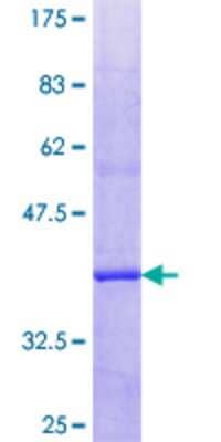 SDS-PAGE: Recombinant Human PLA2G6 GST (N-Term) Protein [H00008398-Q02]