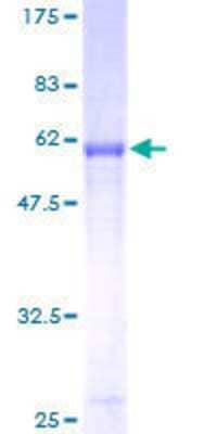 SDS-PAGE: Recombinant Human Syntaxin 7 GST (N-Term) Protein [H00008417-P01]