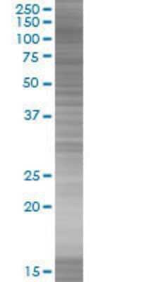 Other: RECK 293T Cell Transient Overexpression Lysate [H00008434-T01]