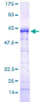 SDS-PAGE: Recombinant Human SPT3 GST (N-Term) Protein [H00008464-P01]