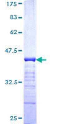 SDS-PAGE: Recombinant Human Plakophilin 4 GST (N-Term) Protein [H00008502-Q01]