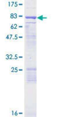 SDS-PAGE: Recombinant Human ENC1 GST (N-Term) Protein [H00008507-P01]