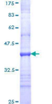 SDS-PAGE: Recombinant Human Integrin alpha 8 GST (N-Term) Protein [H00008516-Q01]