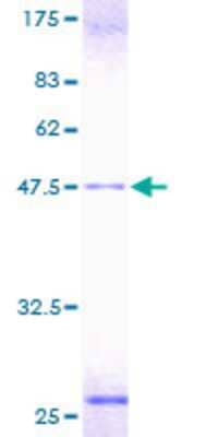 SDS-PAGE: Recombinant Human TCAP GST (N-Term) Protein [H00008557-P01]