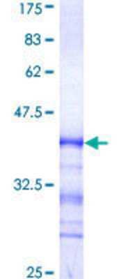 SDS-PAGE: Recombinant Human CDC2L5 GST (N-Term) Protein [H00008621-Q01]