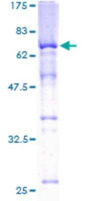 SDS-PAGE: Recombinant Human SKAP55 GST (N-Term) Protein [H00008631-P01]