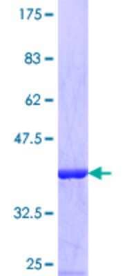 SDS-PAGE: Recombinant Human EIF3G GST (N-Term) Protein [H00008666-Q01]