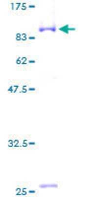 SDS-PAGE: Recombinant Human RIOK3 GST (N-Term) Protein [H00008780-P01]