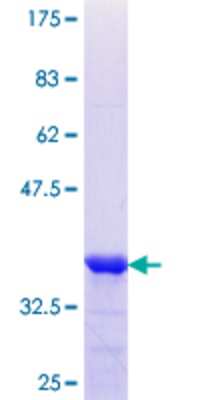 SDS-PAGE: Recombinant Human SCEL GST (N-Term) Protein [H00008796-Q01]