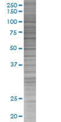 Other: IL18R1 293T Cell Transient Overexpression Lysate [H00008809-T01]