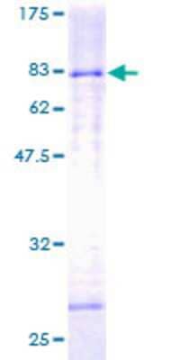 SDS-PAGE: Recombinant Human HDAC3 GST (N-Term) Protein [H00008841-P01]