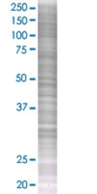 Other: GPR109B/HM74 293T Cell Transient Overexpression Lysate [H00008843-T01]