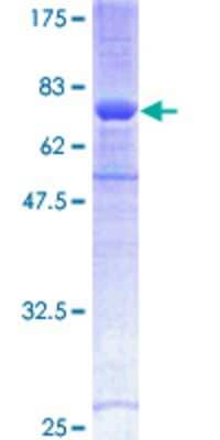 SDS-PAGE: Recombinant Human SCAP2 GST (N-Term) Protein [H00008935-P02]