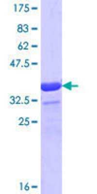 SDS-PAGE: Recombinant Human WASF1/WAVE1 GST (N-Term) Protein [H00008936-Q01]