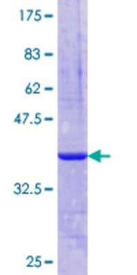 SDS-PAGE: Recombinant Human CH25H GST (N-Term) Protein [H00009023-Q03]