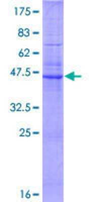 SDS-PAGE: Recombinant Human Claudin-6 GST (N-Term) Protein [H00009074-P01]