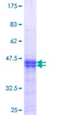 SDS-PAGE: Recombinant Human PKMYT1 GST (N-Term) Protein [H00009088-Q01]