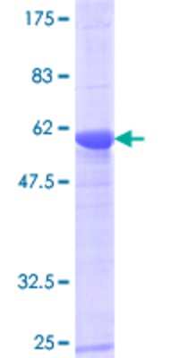 SDS-PAGE: Recombinant Human UNC119 GST (N-Term) Protein [H00009094-P01]