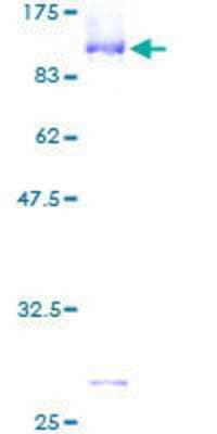 SDS-PAGE: Recombinant Human MTGR1 GST (N-Term) Protein [H00009139-P01]