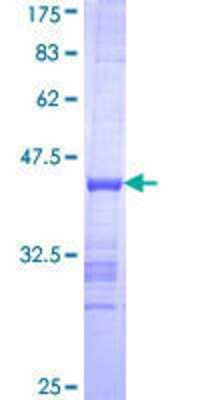 SDS-PAGE: Recombinant Human Exonuclease 1 GST (N-Term) Protein [H00009156-Q01]