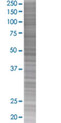 Other: OSMR beta 293T Cell Transient Overexpression Lysate [H00009180-T01]