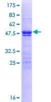 SDS-PAGE: Recombinant Human ZMYM5 GST (N-Term) Protein [H00009205-P01]