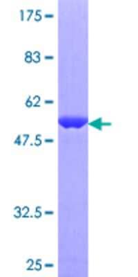 SDS-PAGE: Recombinant Human Rab11 GST (N-Term) Protein [H00009230-P01]