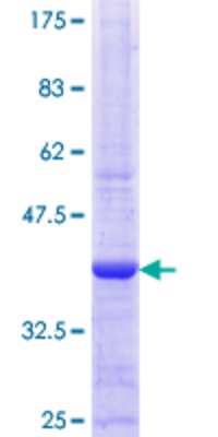 SDS-PAGE: Recombinant Human MSK1/RPS6KA5 GST (N-Term) Protein [H00009252-Q02]