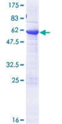 SDS-PAGE: Recombinant Human BCL7B GST (N-Term) Protein [H00009275-P01]