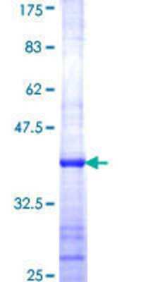 SDS-PAGE: Recombinant Human 60S ribosomal protein L23 GST (N-Term) Protein [H00009349-Q01]