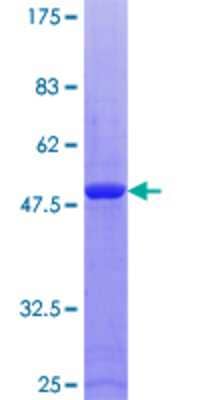 SDS-PAGE: Recombinant Human RAB9A GST (N-Term) Protein [H00009367-P01]