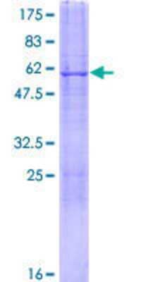 SDS-PAGE: Recombinant Human CDYL GST (N-Term) Protein [H00009425-P01]