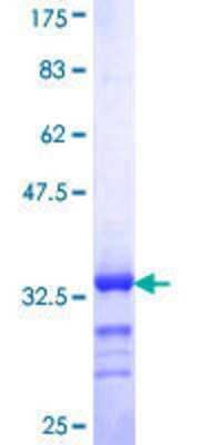 SDS-PAGE: Recombinant Human HCC1 GST (N-Term) Protein [H00009584-Q01]