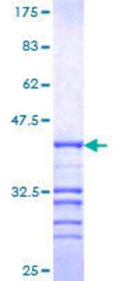 SDS-PAGE: Recombinant Human NCOR1 GST (N-Term) Protein [H00009611-Q01]