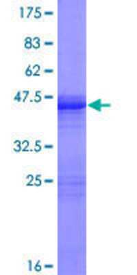 SDS-PAGE: Recombinant Human GCAP3 GST (N-Term) Protein [H00009626-P01]