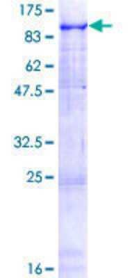 SDS-PAGE: Recombinant Human Synphilin-1 GST (N-Term) Protein [H00009627-P01]