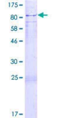 SDS-PAGE: Recombinant Human SOCS-5 GST (N-Term) Protein [H00009655-P02]