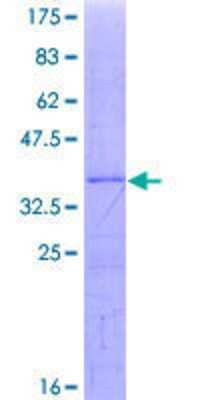 SDS-PAGE: Recombinant Human UBE3C GST (N-Term) Protein [H00009690-Q01]