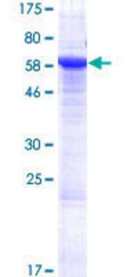 SDS-PAGE: Recombinant Human SUSD6 GST (N-Term) Protein [H00009766-P01]