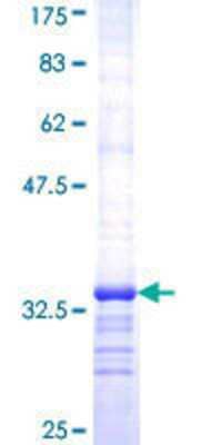 SDS-PAGE: Recombinant Human SV2A GST (N-Term) Protein [H00009900-Q01]