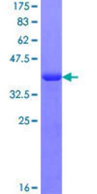 SDS-PAGE: Recombinant Human RABGAP1L GST (N-Term) Protein [H00009910-Q01]