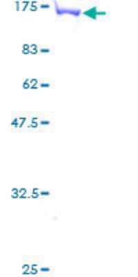 SDS-PAGE: Recombinant Human MVP GST (N-Term) Protein [H00009961-P01]