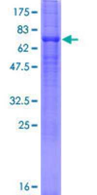 SDS-PAGE: Recombinant Human SLC23A2 GST (N-Term) Protein [H00009962-P01]