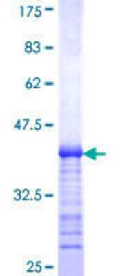 SDS-PAGE: Recombinant Human KCC3/SLC12A6 GST (N-Term) Protein [H00009990-Q01]