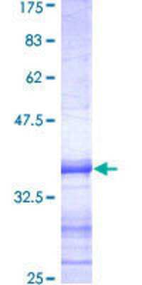 SDS-PAGE: Recombinant Human HDAC5 GST (N-Term) Protein [H00010014-Q01]