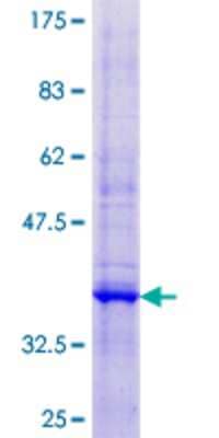 SDS-PAGE: Recombinant Human Map17 GST (N-Term) Protein [H00010158-P01]