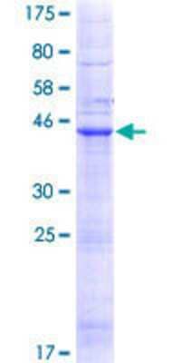 SDS-PAGE: Recombinant Human LHFP GST (N-Term) Protein [H00010186-P01]