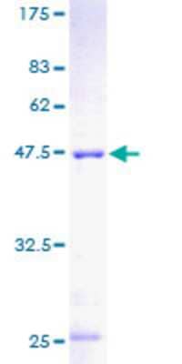 SDS-PAGE: Recombinant Human MPHOSPH6 GST (N-Term) Protein [H00010200-P01]