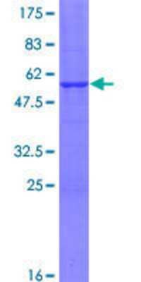 SDS-PAGE: Recombinant Human SSX3 GST (N-Term) Protein [H00010214-P01]